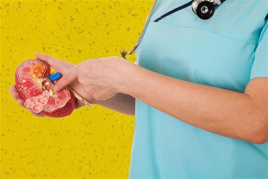 10 علامات تنذرك قبل إصابتك بالفشل الكلوي