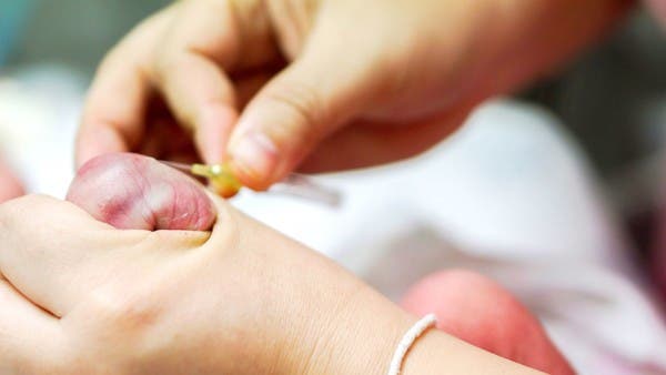 إياكم و"الحيلة العبقرية".. اجتاحت التواصل لإنقاذ مصاب بجلطة