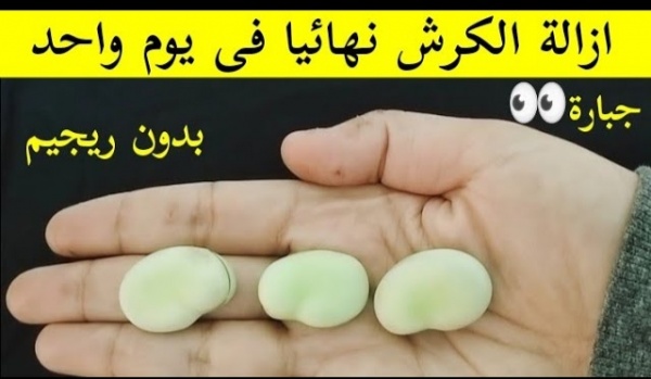 بدون رجيم حبة قبل النوم إزالة الكرش في يوم واحد تخسيس البطن حتى لو كبيرة ومدلدلة