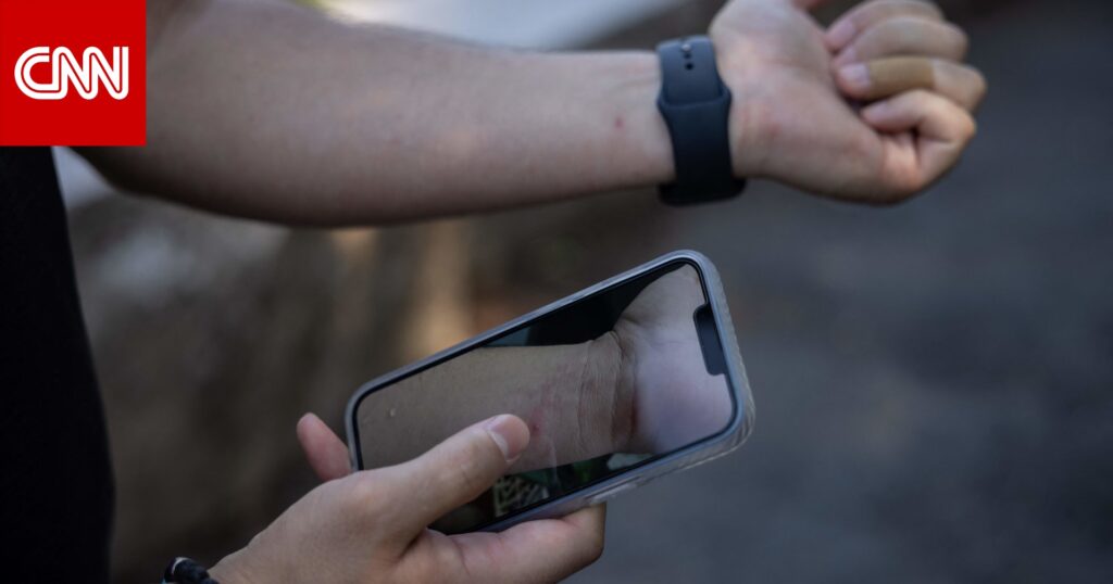 رصد أول إصابة بجدري القردة لدى رجل جرّاء اختلاط "غير جنسي".. ماذا يعني ذلك؟