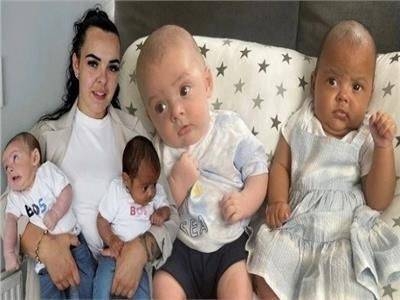 ولادة توأم بلونين مختلفين ووالدتهما تكشف السبب • صحيفة المرصد