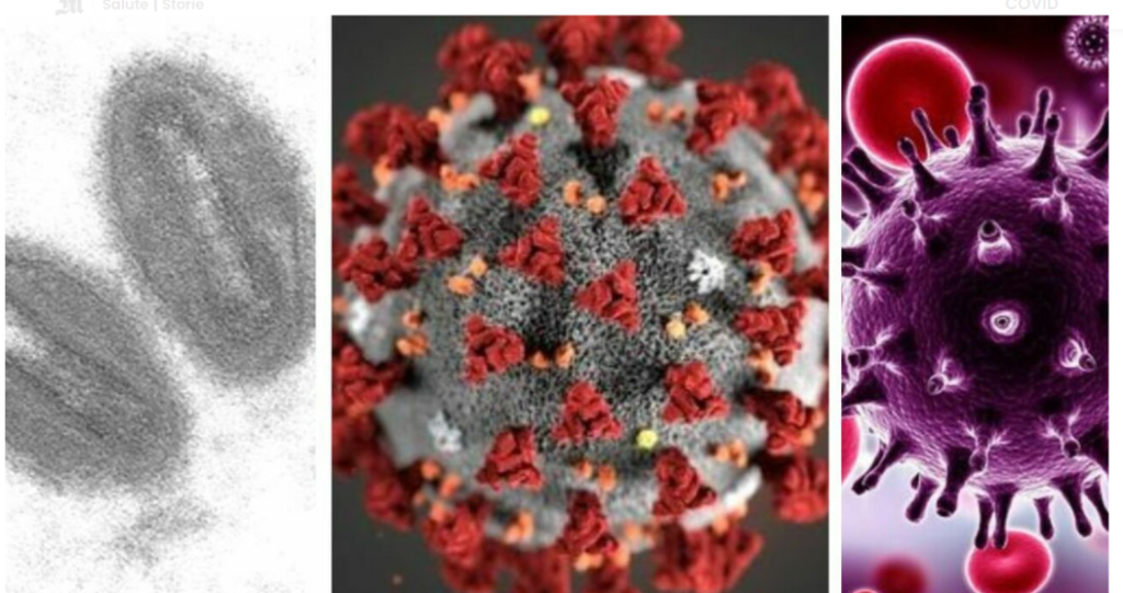 إصابة أول رجل بالعالم بـ كورونا والإيدز وجُدري القرود