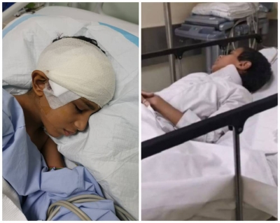إصابة طالب بنزيف وكسر في الجمجمة داخل مدرسة بالرياض.. ووالدته تروي التفاصيل