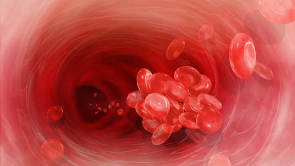 بينها الخبز الأبيض.. 5 أطعمة يمكن أن تسبب جلطات دموية خطيرة