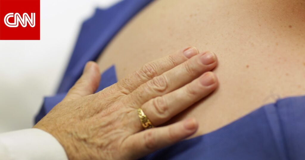 تظهر على شكل طفح جلدي حارق.. ما هي عدوى "الحزام الناري"؟