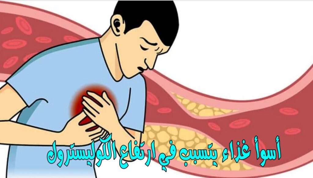 سم قاتل يفقدك حياتك بلمح البصر .. اسوأ طعام يتسبب في ارتفاع الكوليسترول بشكل خطير للغاية .. تعرف عليه وابتعد عنه فوراً