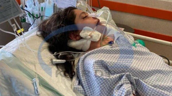 شرطة طهران تنفي قتلها الشابة أميني.. وصور الأشعة تظهر مفاجأة
