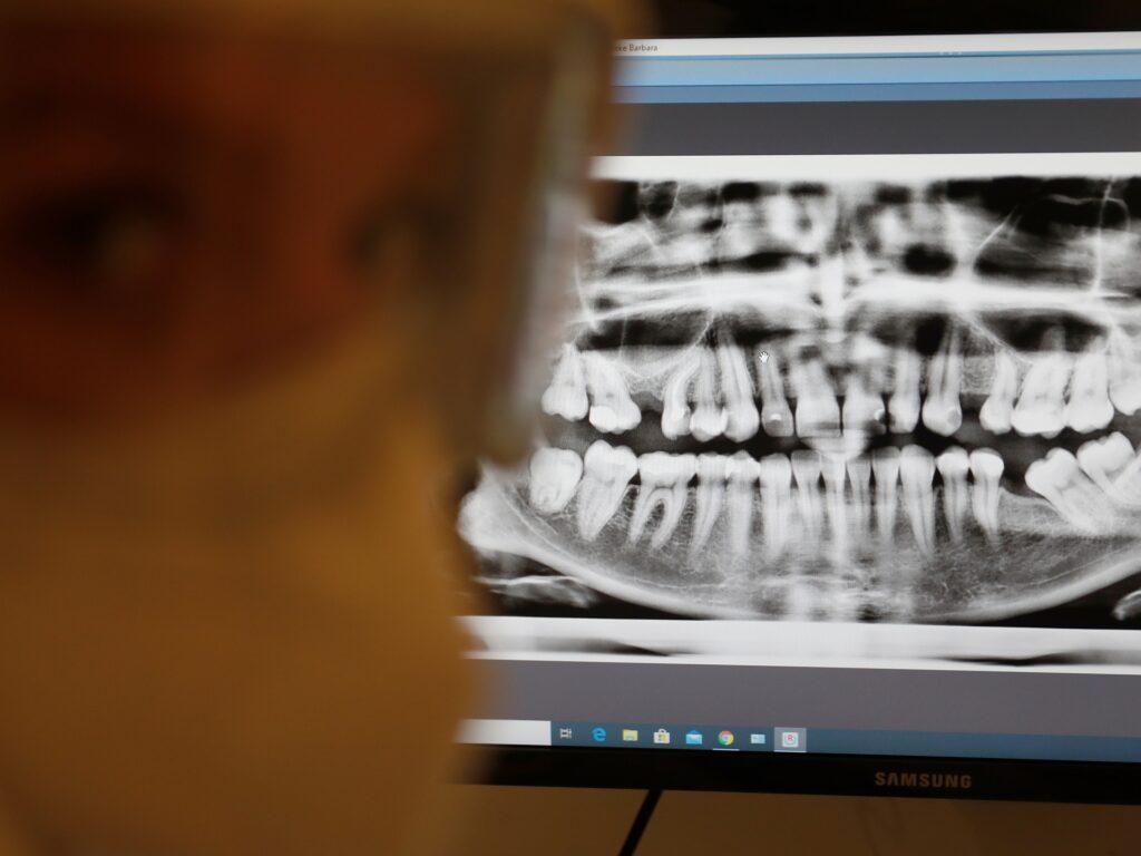 قد يعرضك لخطر تلف الرئة.. دراسة تحذر من إهمال صحة الفم والأسنان | أخبار مع الحكيم