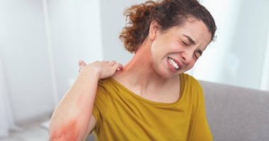 ما هى أسباب الإصابة بالإكزيما