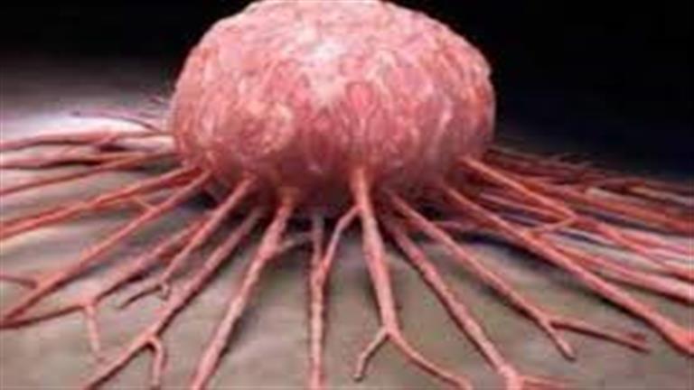 هل هناك علاقة بين النظام الغذائي والسرطان؟