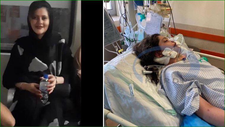 فتاة إيران قبل وبعد ضربها من قبل شرطة الأخلاق