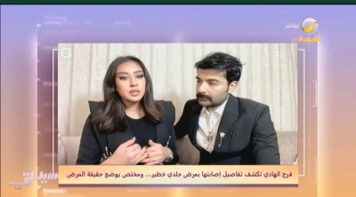 شاهد.. الفنانة الكويتية فرح الهادي تكشف تفاصيل إصابتها بمرض جلدي خطير.. وتطورات حالتها الصحية