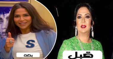هل خضعت نوال الكويتية لعملية تجميل؟.. اعرف التفاصيل