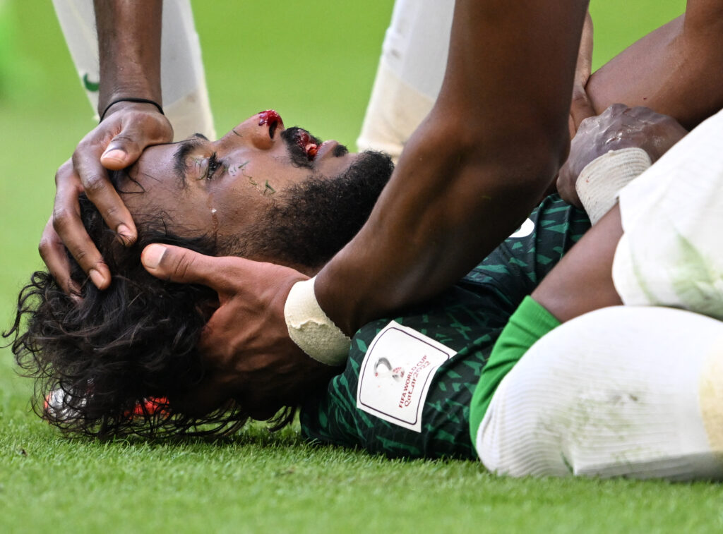 بعد الإصابة القوية وعملية البنكرياس.. نجم المنتخب السعودي يخضع لجراحة جديدة