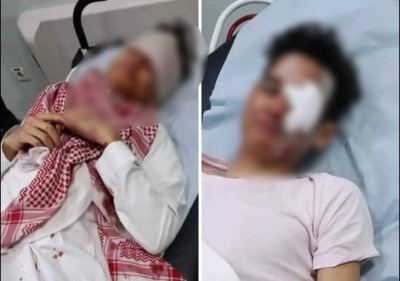 تفاصيل إصابة طالب ثانوية مصري في عينه أثناء مشاجرة داخل مدرسة في بريدة