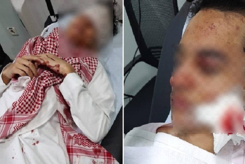 شجار يصيب طالبا في عينه.. ووالده لـ«عكاظ»: تسبب بنزيف وتهتك بالقرنية - أخبار السعودية