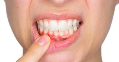 ما علاقة أمراض الفم والأسنان بمشاكل القلب؟